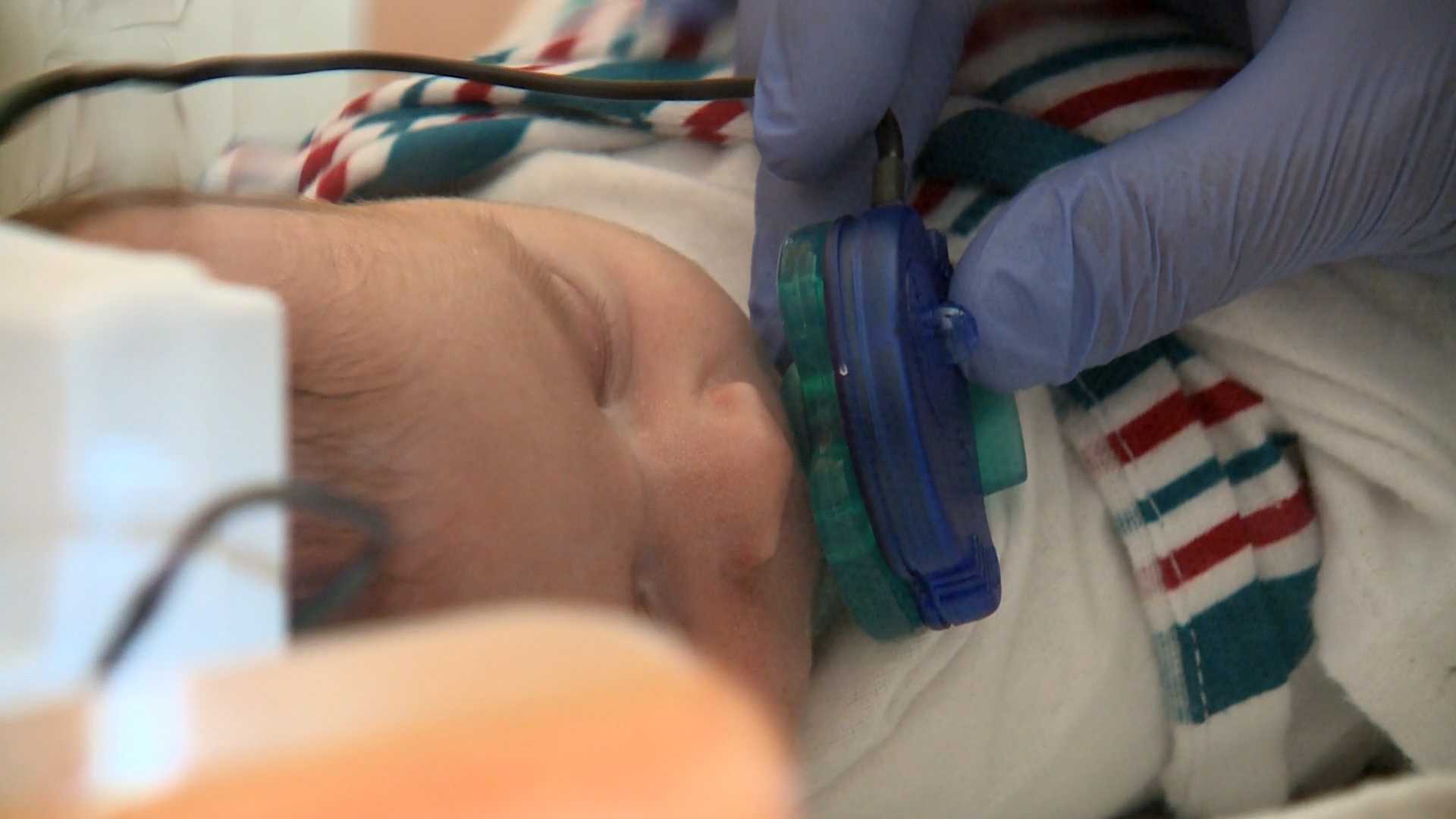 New device helps tiniest victims of the opioid crisis