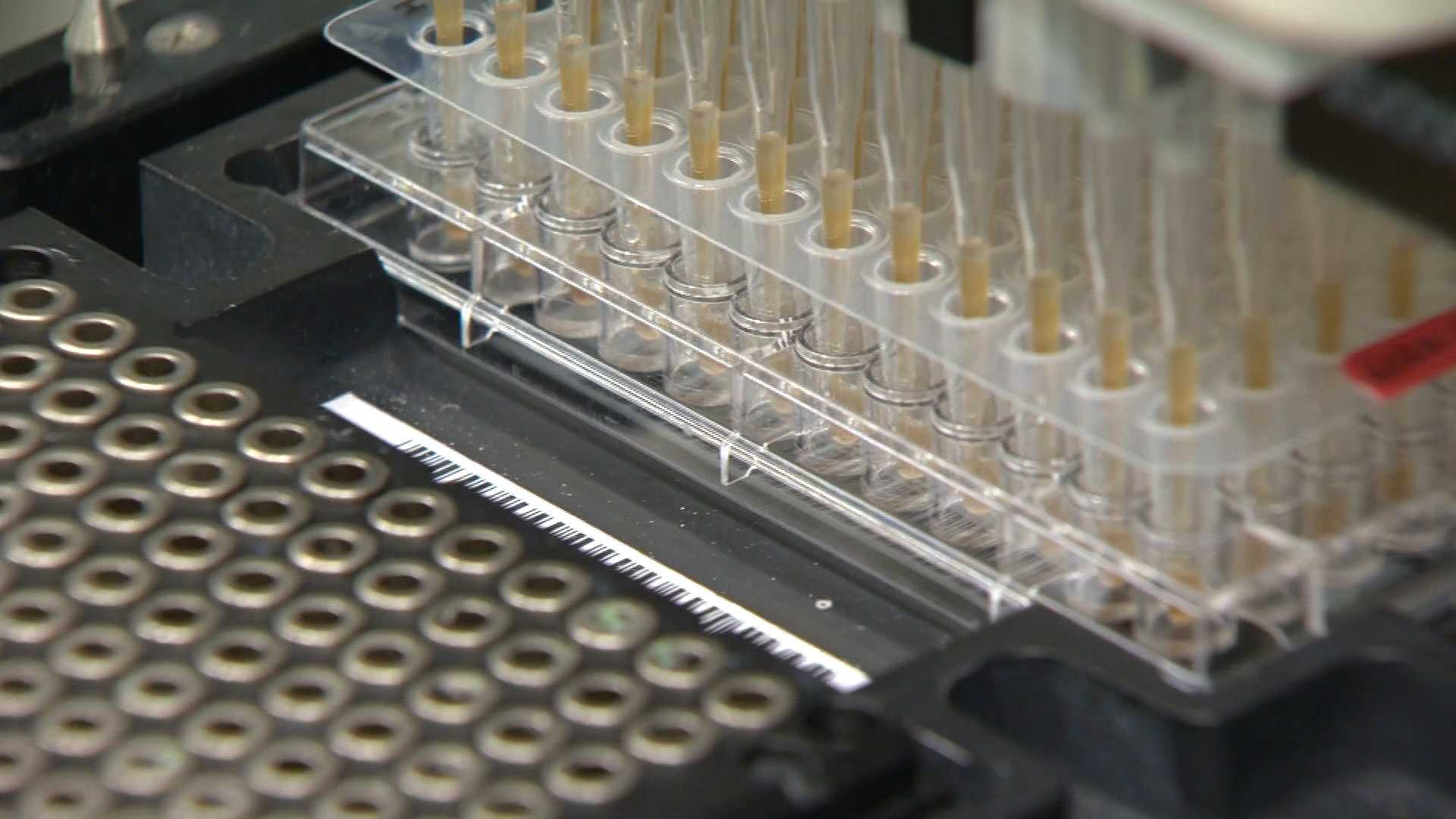 Blood test could detect cancer before symptoms show
