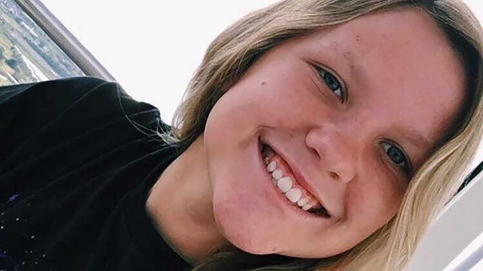 This teen was roasting marshmallows on New Year's Eve, then a gas can exploded