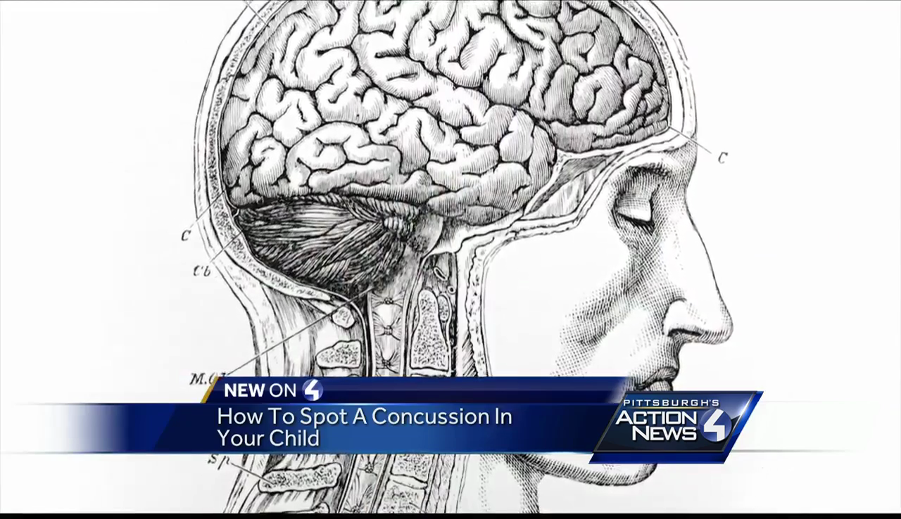 How to spot a concussion in your child