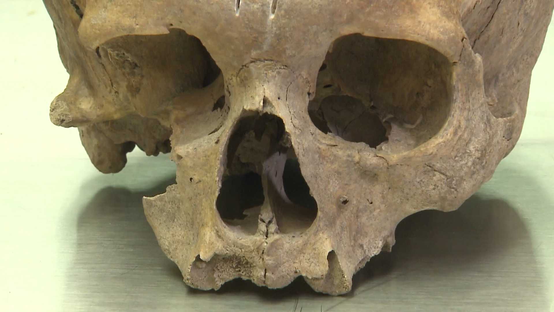 Human skull discovery still stumps forensic investigators one year later