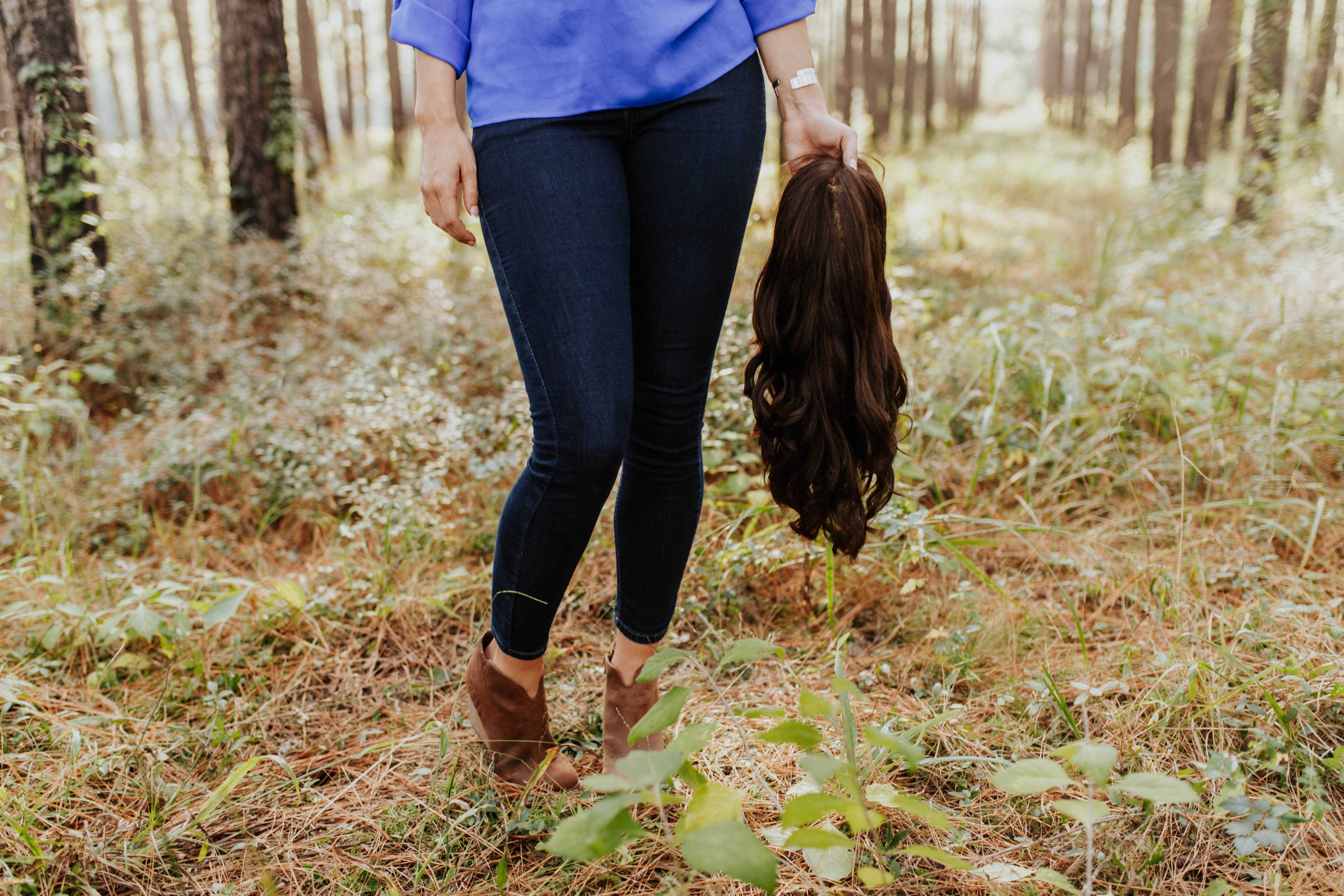 Why this gorgeous bride-to-be with Alopecia removed her wig for her engagement photos